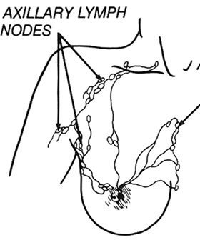 Sentinel+lymph+node+biopsy+recovery+time