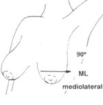 Medio lateral view 