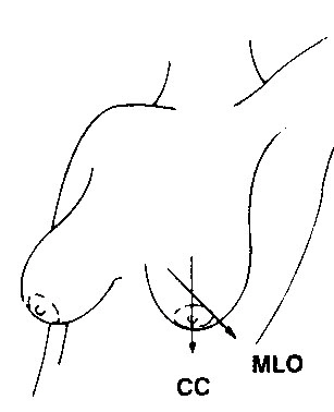 Cranio-caudal & mediolateral oblique view