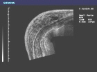 This detailed image of normal breast tissue uses panoramic ultrasound imaging.