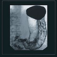 Upper Gastro-Intestinal (GI) x-ray showing the stomach