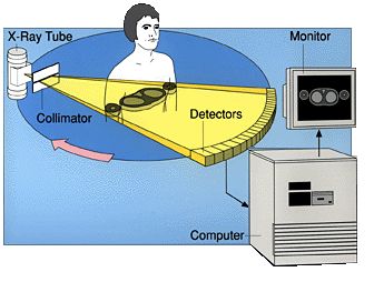 Diagram of CT xray path