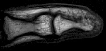 Hi Resolution MRI of a finger