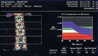 DEXA Scan image and results