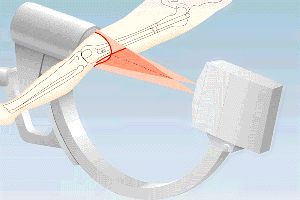 Diagram showing the path of an x-ray beam